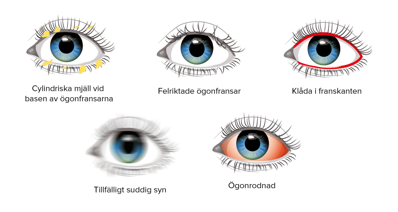 Bilder röda ögon demodex torra ögon